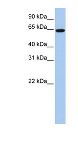 EPS8L1 antibody LS-C110695 Western blot of HeLa lysate.