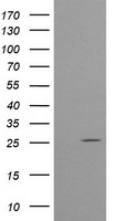 HEK293T cells were transfected with the pCMV6-ENTRY control (Left lane) or pCMV6-ENTRY CMPK1 (Right lane) cDNA for 48 hrs and lysed. Equivalent amounts of cell lysates (5 ug per lane) were separated by SDS-PAGE and immunoblotted with anti-CMPK1.