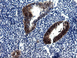 IHC of paraffin-embedded Human endometrium tissue using anti-CMPK1 mouse monoclonal antibody.