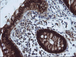 IHC of paraffin-embedded Human colon tissue using anti-CMPK1 mouse monoclonal antibody.