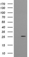 HEK293T cells were transfected with the pCMV6-ENTRY control (Left lane) or pCMV6-ENTRY CMPK1 (Right lane) cDNA for 48 hrs and lysed. Equivalent amounts of cell lysates (5 ug per lane) were separated by SDS-PAGE and immunoblotted with anti-CMPK1.