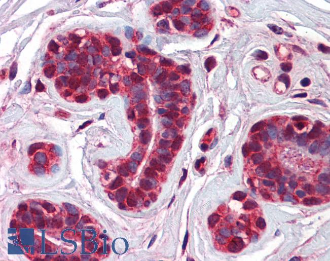 Anti-CHFR antibody IHC of human breast. Immunohistochemistry of formalin-fixed, paraffin-embedded tissue after heat-induced antigen retrieval. Antibody LS-B5739 concentration 2.5 ug/ml.