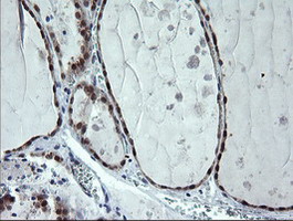 IHC of paraffin-embedded Human thyroid tissue using anti-CMPK1 mouse monoclonal antibody.