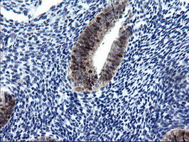 IHC of paraffin-embedded Human endometrium tissue using anti-CMPK1 mouse monoclonal antibody.