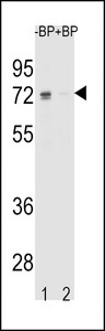 Western blot of ESR1 isoform1 Antibody antibody pre-incubated without(lane 1) and with(lane 2) blocking peptide in K562 cell line lysate. ESR1 isoform1 Antibody (arrow) was detected using the purified antibody.