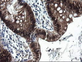IHC of paraffin-embedded Human colon tissue using anti-CMPK1 mouse monoclonal antibody.