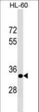 ERAL1 Antibody western blot of HL-60 cell line lysates (35 ug/lane). The ERAL1 antibody detected the ERAL1 protein (arrow).