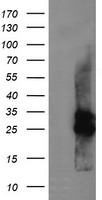 HEK293T cells were transfected with the pCMV6-ENTRY control (Left lane) or pCMV6-ENTRY CMPK1 (Right lane) cDNA for 48 hrs and lysed. Equivalent amounts of cell lysates (5 ug per lane) were separated by SDS-PAGE and immunoblotted with anti-CMPK1.