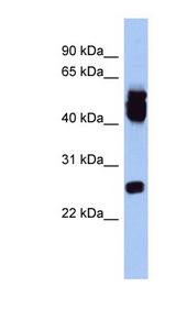 ERAS antibody LS-C111709 Western blot of Fetal Lung lysate.