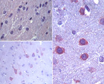 IHC of ERAS in paraffin-embedded formalin-fixed rat brain tissue using an isotype control (top, left) and LS-C148431 (bottom left, and right) at 1:100.