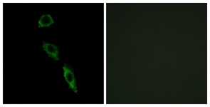 Immunofluorescence of A549 cells, using ERAS Antibody. The picture on the right is treated with the synthesized peptide.