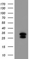 HEK293T cells were transfected with the pCMV6-ENTRY control (Left lane) or pCMV6-ENTRY ERAS (Right lane) cDNA for 48 hrs and lysed. Equivalent amounts of cell lysates (5 ug per lane) were separated by SDS-PAGE and immunoblotted with anti-ERAS.