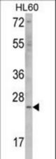Western blot of ERAS Antibody (F66) in HL60 cell line lysates (35 ug/lane). ERAS (arrow) was detected using the purified antibody.
