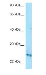 CMPK / CMPK1 antibody Western Blot of Mouse Heart.