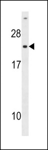 The anti-UCK antibody is used in Western blot to detect UCK in HepG2 cell lysate (Lane 1) and mouse cerebellum tissue lysate (Lane 2).