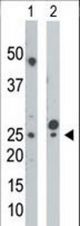 The anti-UCK antibody is used in Western blot to detect UCK in mouse cerebellum tissue lysate (Lane 1) and HepG2 cell lysate (Lane 2).
