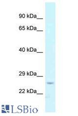 CMPK / CMPK1 antibody Western Blot of Fetal Liver. Antibody dilution: 1 ug/ml.