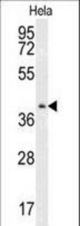Western blot of CMPK2 Antibody in HeLa cell line lysates (35 ug/lane). CMPK2 (arrow) was detected using the purified antibody.