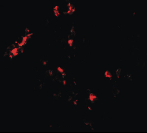 Immunofluorescence of CMPK2 in human lung tissue with CMPK2 antibody at 20 ug/ml.
