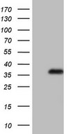 HEK293T cells were transfected with the pCMV6-ENTRY control (Left lane) or pCMV6-ENTRY CHMP4C (Right lane) cDNA for 48 hrs and lysed. Equivalent amounts of cell lysates (5 ug per lane) were separated by SDS-PAGE and immunoblotted with Rabbit polyclonal anti-CHMP4C antibody at 1:500 dilution.