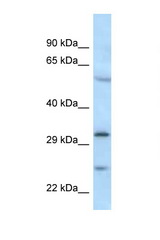 MAD2L1BP antibody LS-C145504 Western blot of 435S Cell lysate. Antibody concentration 1 ug/ml.