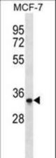 MAD2L1BP Antibody western blot of MCF-7 cell line lysates (35 ug/lane). The MAD2L1BP antibody detected the MAD2L1BP protein (arrow).
