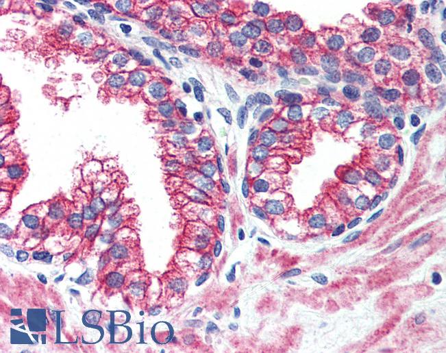 Anti-ERBB2 / HER2 antibody LS-A9396 IHC of human prostate. Immunohistochemistry of formalin-fixed, paraffin-embedded tissue after heat-induced antigen retrieval.