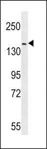 HER4 Antibody (pY1162) western blot of mouse NIH-3T3 cell line lysates (35 ug/lane). The HER4 antibody detected the HER4 protein (arrow).