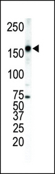 Western blot of anti-ErbB4 antibody in T-47D cell lysate. ErbB4 (arrow) was detected using purified antibody. Secondary HRP-anti-rabbit was used for signal visualization with chemiluminescence.
