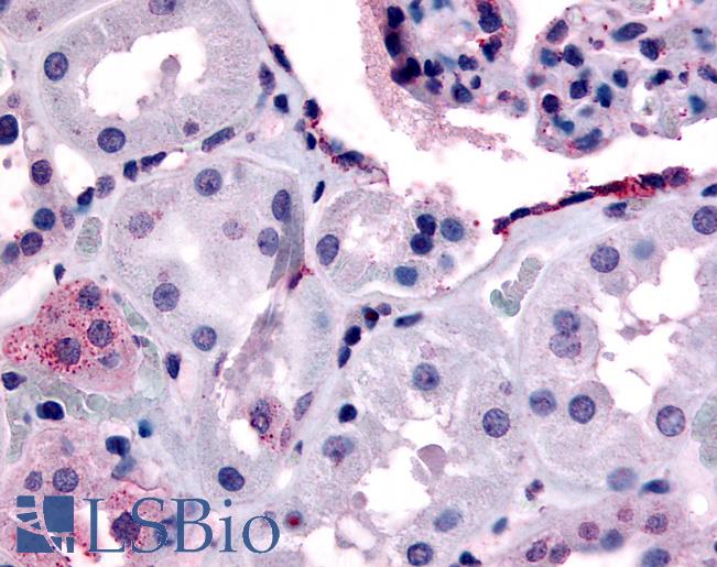 Anti-ERBB4 antibody LS-A2846 IHC of human glomerulus and renal tubular epithelium in cortex. Immunohistochemistry of formalin-fixed, paraffin-embedded tissue after heat-induced antigen retrieval.