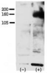 Phospho-HER4-Y1162 Antibody was used to detect Phospho-HER4-Y1162 in FG pancreatic carcinoma cell line lysate. FG pancreatic carcinoma cells treated with or without EGF (50ng/ml) for 15 min Phospho-HER4-Y1162 Antibody was used at 1:750 in 3% BSA. Data and protocol kindly provided by Dr. Weis of Cheresh Lab, UCSD.