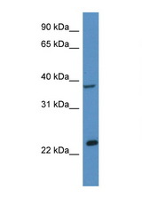 ERCC1 antibody LS-C145284 Western blot of Mouse Liver lysate. Antibody concentration 1 ug/ml.