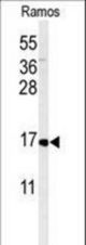 Western blot of CMTM7 Antibody in Ramos cell line lysates (35 ug/lane). CMTM7 (arrow) was detected using the purified antibody.