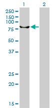 Western Blot analysis of ERCC2 expression in transfected 293T cell line by ERCC2 monoclonal antibody (M01), clone 4G2-2A6.Lane 1: ERCC2 transfected lysate(86.9 KDa).Lane 2: Non-transfected lysate.