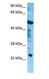CHMP6 antibody Western Blot of HepG2.