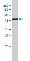 ERCC2 monoclonal antibody (M01), clone 4G2-2A6 Western Blot analysis of ERCC2 expression in HeLa NE.