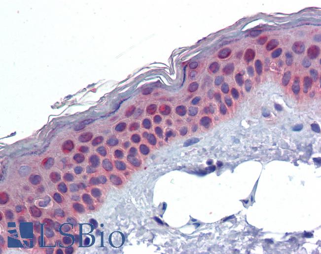 Anti-ERCC2 / XPD antibody IHC of human skin. Immunohistochemistry of formalin-fixed, paraffin-embedded tissue after heat-induced antigen retrieval. Antibody LS-B3814 concentration 3.75 ug/ml.