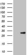 Human recombinant protein fragment corresponding to amino acids 78-307 of human ERCC2 (NP_000391) produced in E.coli.