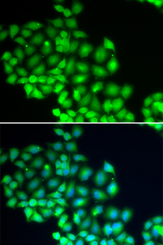 Immunofluorescence blot of HeLa cell using ERCC2 antibody. Blue: DAPI for nuclear staining.