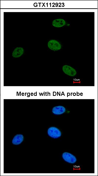 Immunofluorescence of paraformaldehyde-fixed HeLa, using XPB antibody at 1:200 dilution.