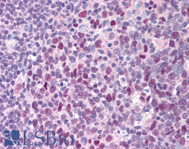 Anti-ERCC3 / XPB antibody IHC of human tonsil. Immunohistochemistry of formalin-fixed, paraffin-embedded tissue after heat-induced antigen retrieval. Antibody LS-B1693 concentration 10 ug/ml.