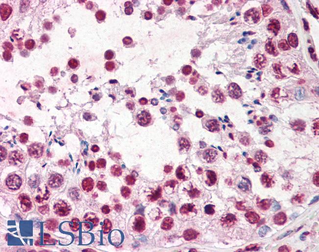 Anti-ERCC3 / XPB antibody IHC of human testis. Immunohistochemistry of formalin-fixed, paraffin-embedded tissue after heat-induced antigen retrieval. Antibody LS-B2815 concentration 10 ug/ml.