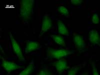 Immunostaining analysis in HeLa cells. HeLa cells were fixed with 4% paraformaldehyde and permeabilized with 0.1% Triton X-100 in PBS. The cells were immunostained with anti-ERCC3 mAb.