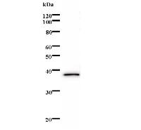 Western blot analysis of immunized recombinant protein, using anti-ERCC3 monoclonal antibody.