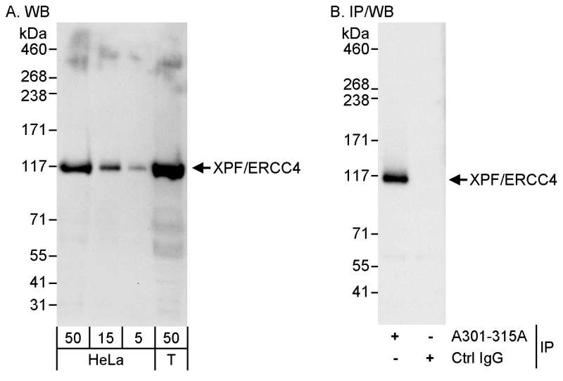 Detection of Human XPF/ERCC4 by Western Blot and Immunoprecipitation. Samples: Whole cell lysate from HeLa (5, 15 and 50 ug for WB; 1 mg for IP, 20% of IP loaded) and 293T (T; 50 ug) cells. Antibodies: Affinity purified rabbit anti-XPF/ERCC4 antibody used for WB at 0.04 ug/ml (A) and 1 ug/ml (B) and used for IP at 3 ug/mg lysate. Detection: Chemiluminescence with exposure times of 30 seconds (A) and 3 seconds (B).