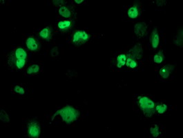Anti-ERCC4 mouse monoclonal antibody immunofluorescent staining of COS7 cells transiently transfected by pCMV6-ENTRY ERCC4.