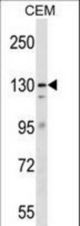 ERCC5 Antibody western blot of CEM cell line lysates (35 ug/lane). The ERCC5 antibody detected the ERCC5 protein (arrow).