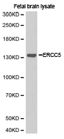 Western blot of extracts of fetal brain lysate, using ERCC5 antibody.