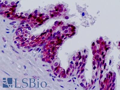 Human, Prostate: Formalin-Fixed Paraffin-Embedded (FFPE)
