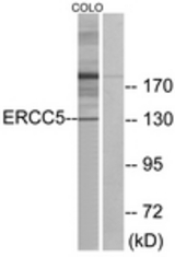 Western blot of extracts from COLO cells, using ERCC5 Antibody. The lane on the right is treated with the synthesized peptide.